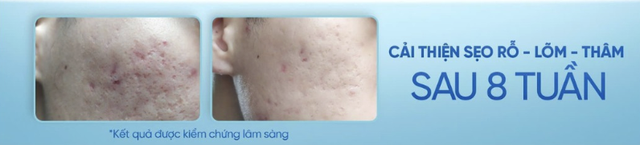 V&igrave; sao Scar Esthetique l&agrave; sản phẩm d&agrave;nh cho th&acirc;m đỏ sau mụn? - Ảnh 8.