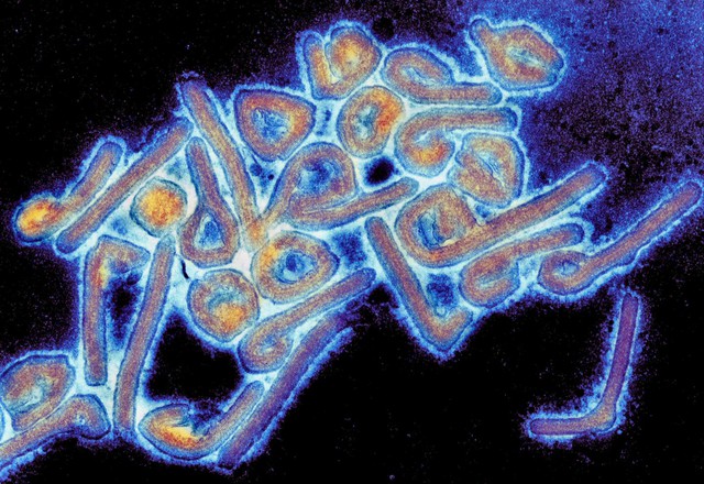 Ethiopia bùng phát virus Marburg, tỷ lệ tử vong cao ngang Ebola - Ảnh 1.