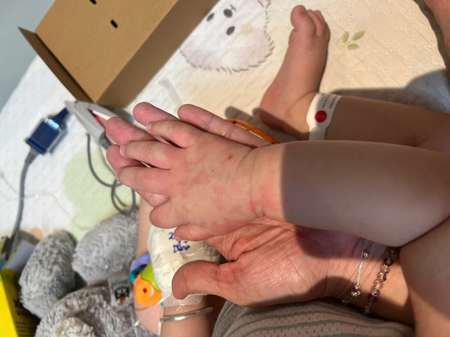 TP.HCM: Trẻ sốt kh&ocirc;ng hạ, đi kh&aacute;m b&aacute;c sĩ ph&aacute;t hiện mắc bệnh hiếm gặp- Ảnh 1.