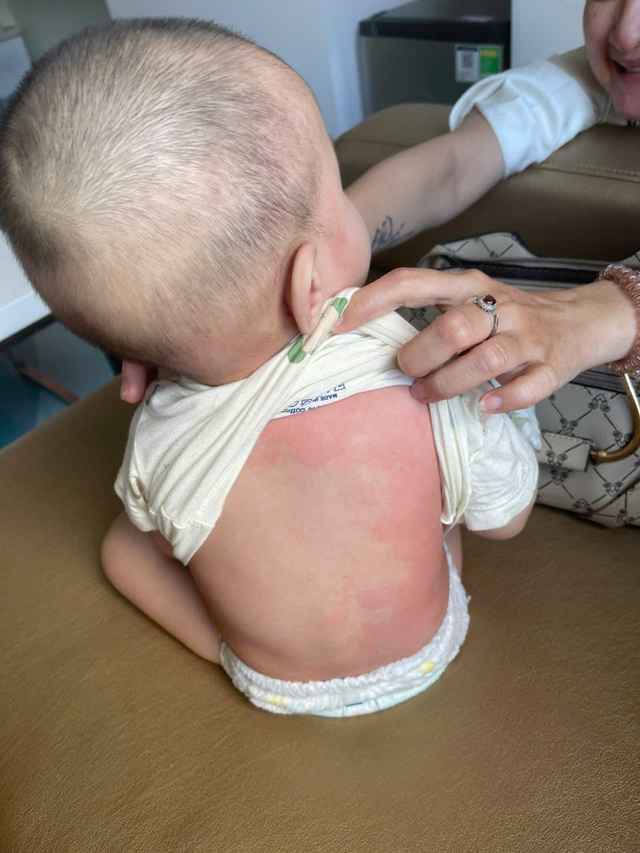 TP.HCM: Trẻ sốt kh&ocirc;ng hạ, đi kh&aacute;m b&aacute;c sĩ ph&aacute;t hiện mắc bệnh hiếm gặp- Ảnh 2.