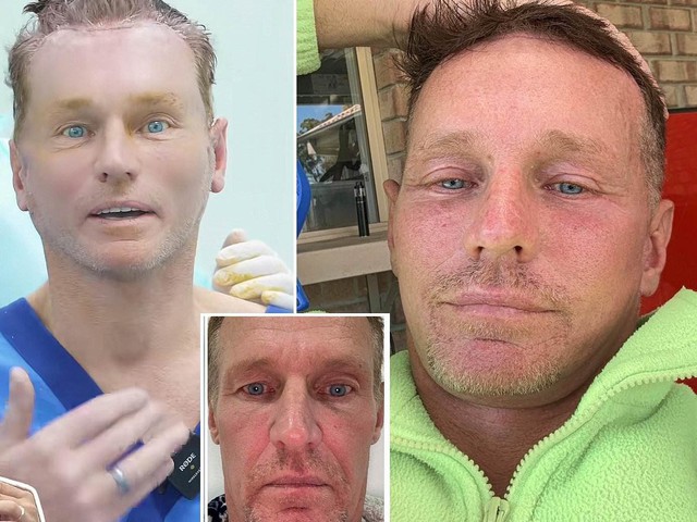 Người đàn ông Úc trở thành hiện tượng mạng nhờ phẫu thuật thẩm mỹ tại Việt Nam - Ảnh 1.