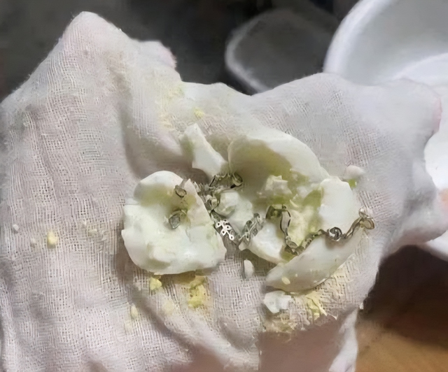 Trẻ sốt cao: Bác sĩ cảnh báo không nên lăn trứng hay để 'giảm sốt tự nhiên' - Ảnh 1.