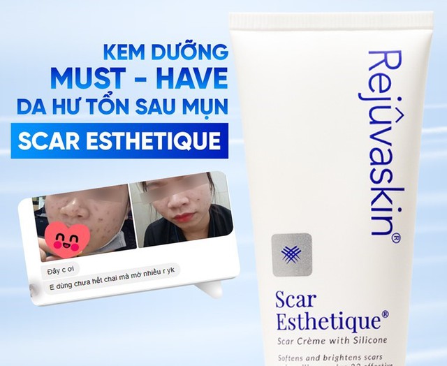 5 l&yacute; do khiến nốt th&acirc;m đỏ v&agrave; th&acirc;m n&acirc;u sau mụn m&atilde;i kh&ocirc;ng hết- Ảnh 1.