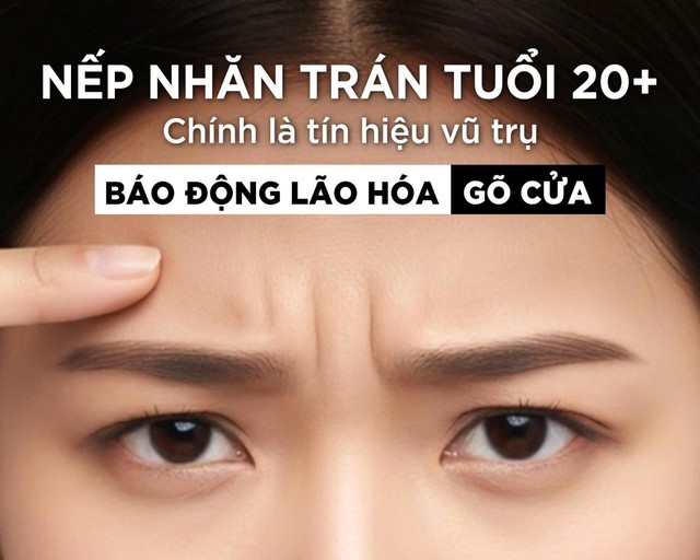 Nếp nhăn trán tuổi 20+ chính là ‘tín hiệu vũ trụ’ báo động lão hóa ‘gõ cửa’- Ảnh 1.