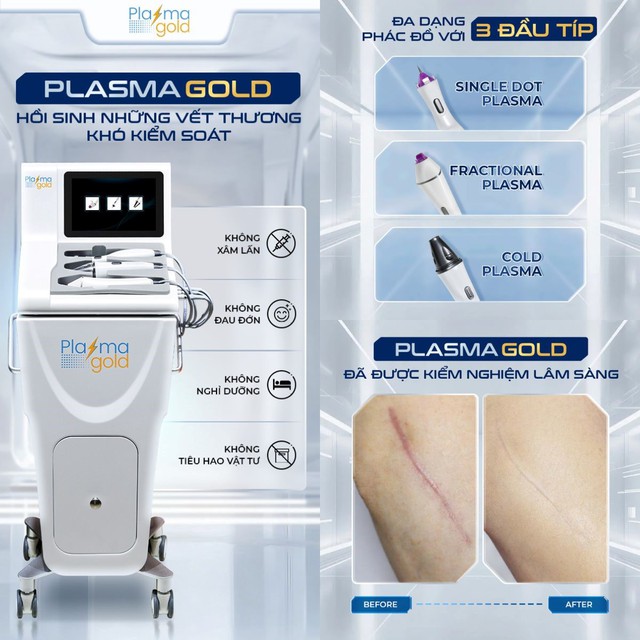 Plasma Gold c&oacute; thể hỗ trợ xử l&yacute; sẹo lồi sau phẫu thuật kh&ocirc;ng? - Ảnh 4.
