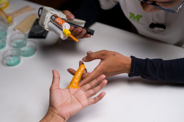 Startup Việt dùng công nghệ để phục hình thẩm mỹ silicone thụ động - Ảnh 1.