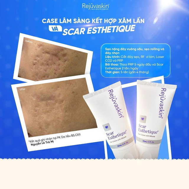 - Ảnh 3. - Ảnh 3.