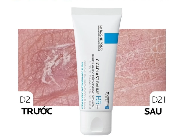  10 kem dưỡng ẩm cho da nhạy cảm kh&ocirc; r&aacute;p, mỏng yếu cỡ n&agrave;o cũng căng b&oacute;ng  - Ảnh 11.