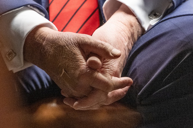 Tổng thống Trump bắt tay nhiều đến mức phải dán băng cá nhân?- Ảnh 2. Tổng thống Trump bắt tay nhiều đến mức phải dán băng cá nhân?- Ảnh 2.