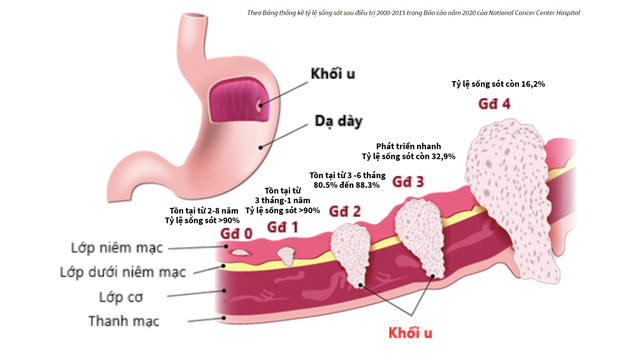 Chỉ chậm 2 tháng, ung thư đã hình thành: Tầm soát sớm và định kỳ thế nào?- Ảnh 1. Chỉ chậm 2 tháng, ung thư đã hình thành: Tầm soát sớm và định kỳ thế nào?- Ảnh 1.