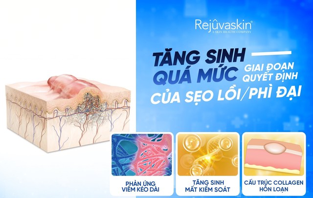 Nâng cấp hiệu quả điều trị sẹo lồi với lời khuyên từ chuyên gia da liễu - Ảnh 2.