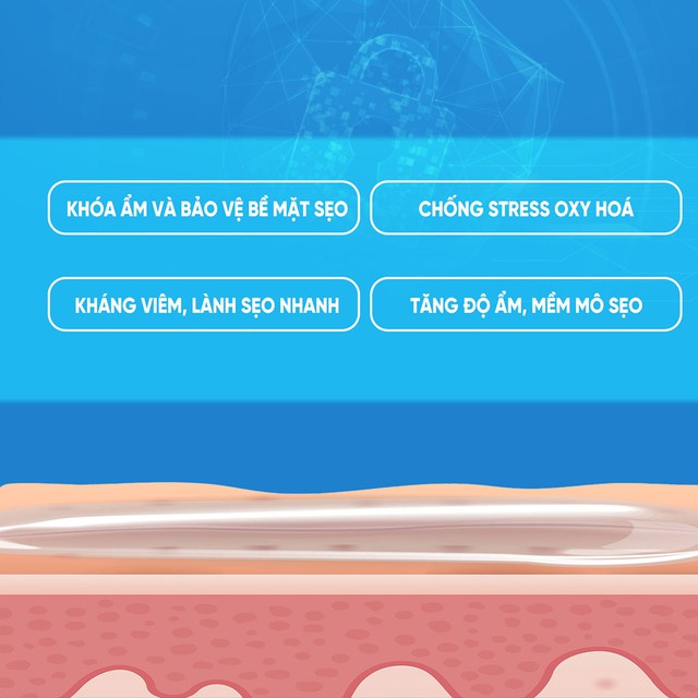 Những điều bạn cần biết trước khi chăm sóc sẹo lồi/phì đại - Ảnh 6.