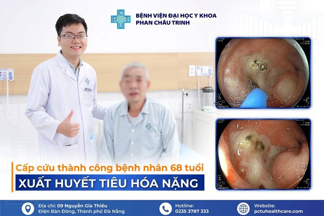 Cứu sống nam bệnh nh&acirc;n 68 tuổi bị xuất huyết ti&ecirc;u h&oacute;a nặng - Ảnh 2.