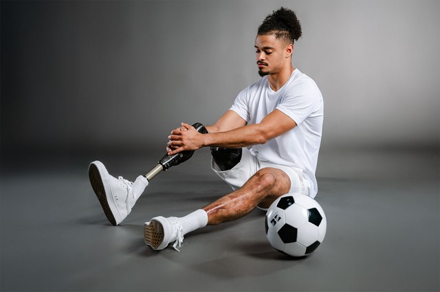 Nỗi đau người mẹ khi con trai cầu thủ cắt bỏ ch&acirc;n v&igrave; bệnh n&atilde;o m&ocirc; cầu - Ảnh 2.