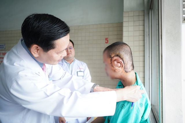 Bệnh viện Chợ Rẫy 'trả lại' gương mặt cho bệnh nhân bị u khủng làm biến dạng- Ảnh 3. Bệnh viện Chợ Rẫy 'trả lại' gương mặt cho bệnh nhân bị u khủng làm biến dạng- Ảnh 3.