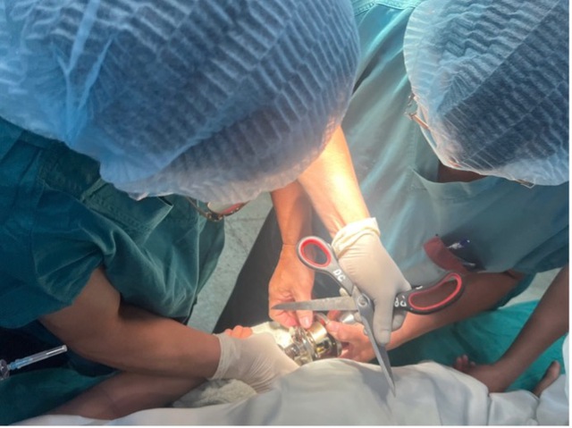 B&eacute; trai kẹt ng&oacute;n tay v&agrave;o ổ kh&oacute;a tr&ograve;n, b&aacute;c sĩ 'h&oacute;a' th&agrave;nh thợ sửa kh&oacute;a - Ảnh 2.