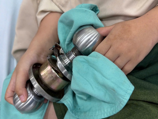 B&eacute; trai kẹt ng&oacute;n tay v&agrave;o ổ kh&oacute;a tr&ograve;n, b&aacute;c sĩ 'h&oacute;a' th&agrave;nh thợ sửa kh&oacute;a - Ảnh 1.