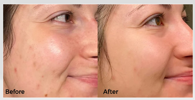 Da mặt bị kh&ocirc; nẻ được bơm căng mọng &lsquo;ngập nước&rsquo; nhờ top 5 kem cấp ẩm- Ảnh 3.