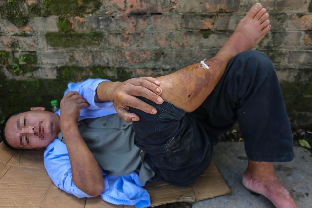 Người đ&agrave;n &ocirc;ng bị nh&oacute;m thiếu ni&ecirc;n đ&aacute;nh đập: 'X&oacute;t xa những vết thương tr&ecirc;n người'- Ảnh 1.