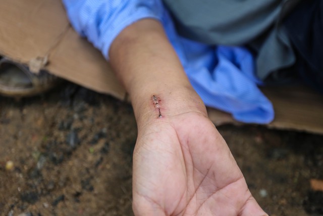 Người đ&agrave;n &ocirc;ng bị nh&oacute;m thiếu ni&ecirc;n đ&aacute;nh đập: 'X&oacute;t xa những vết thương tr&ecirc;n người'- Ảnh 3.