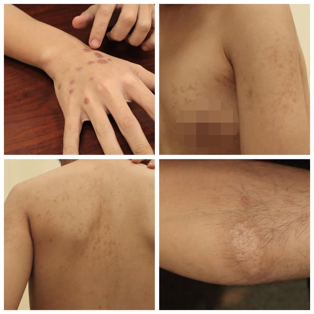 Bẫy lừa đảo xuy&ecirc;n bi&ecirc;n giới: Tra tấn bằng nhựa n&oacute;ng, ch&iacute;ch điện- Ảnh 2.