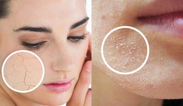 Tuyệt chi&ecirc;u mới gi&uacute;p da ẩm mịn, căng b&oacute;ng ngay trong m&ugrave;a lạnh hanh kh&ocirc;- Ảnh 2.