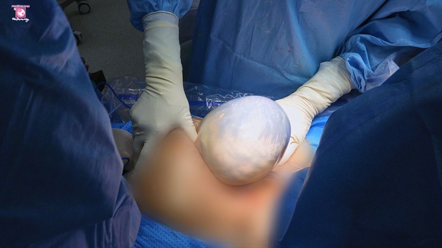 Cặp song sinh ch&agrave;o đời trong bọc điều tại Bệnh viện Phương Nam - Ảnh 1.