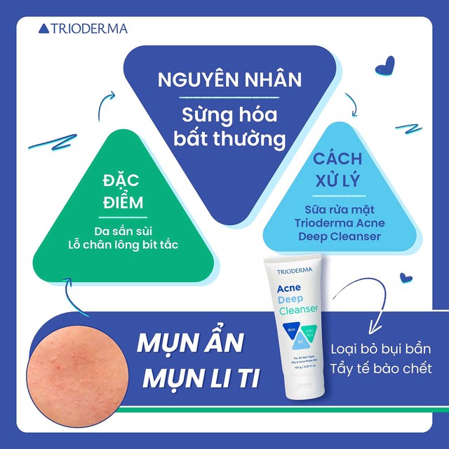 Bất ngờ chưa: Trioderma ngừa mụn ẩn hiệu quả đến mức chuy&ecirc;n gia cũng phải c&ocirc;ng nhận!- Ảnh 3.