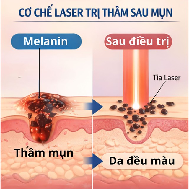 - Ảnh 2. - Ảnh 2.