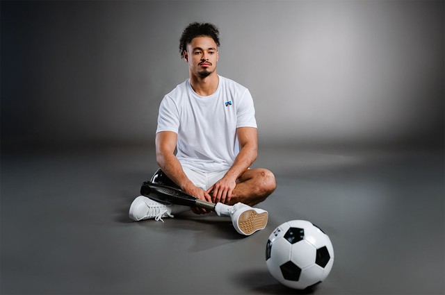 Cầu thủ Pháp cắt bỏ chân vì mắc não mô cầu: Bệnh rình rập người trẻ khỏe - Ảnh 1.