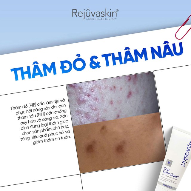 4 tuần giúp da thâm mụn hóa sáng mịn với công thức dịu lành từ thiên nhiên - Ảnh 2.