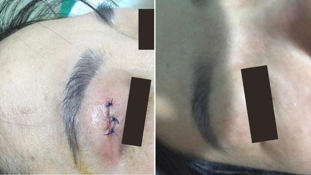 Hema và kỷ nguyên phục hồi từ giai đoạn 0 trong thẩm mỹ hiện đại- Ảnh 3. Hema và kỷ nguyên phục hồi từ giai đoạn 0 trong thẩm mỹ hiện đại- Ảnh 3.