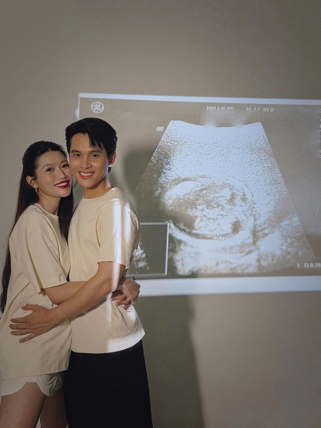 Á hậu Quỳnh Châu đón tin vui bên chồng doanh nhân - Ảnh 1.