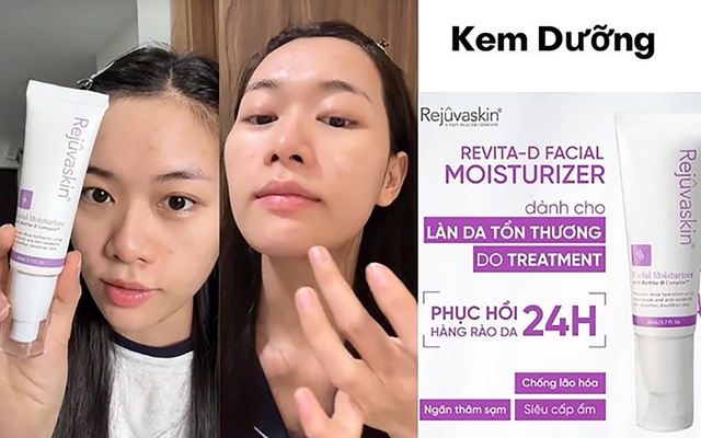 Review kem chống lão hóa Rejuvaskin Facial Moisturizer có thật sự lọt top sản phẩm ‘triệu đơn’?- Ảnh 1.