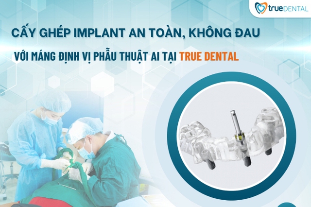 Cấy ghép Implant an toàn, không đau với máng định vị phẫu thuật AI tại True Dental- Ảnh 1.