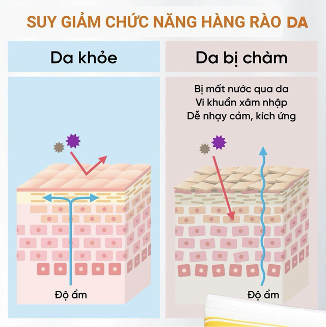 Những câu hỏi thường gặp về kem dưỡng ẩm cho da chàm khô- Ảnh 2.