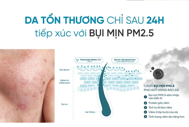 Hiểu cách bụi mịn PM2.5 phá hủy hàng rào da của chúng ta- Ảnh 3.