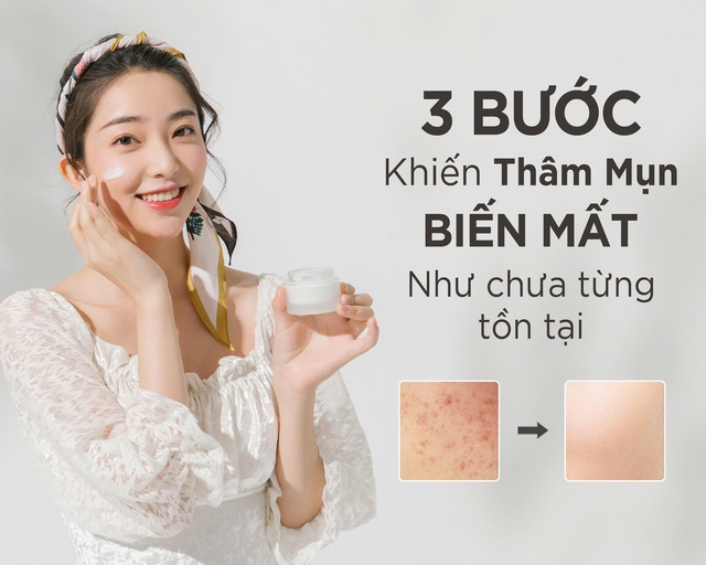 3 bước biến hình làn da, thâm mụn ‘biến mất' như chưa từng tồn tại - Ảnh 1.