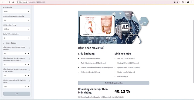 Bác sĩ phát triển AI cảnh báo biến chứng viêm ruột thừa nâng cao độ chính xác - Ảnh 3.