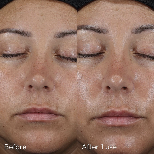 Kem chống nắng Image SPF50 có bảo vệ da toàn diện, ngăn ngừa nám và lão hóa?- Ảnh 4. Kem chống nắng Image SPF50 có bảo vệ da toàn diện, ngăn ngừa nám và lão hóa?- Ảnh 4.