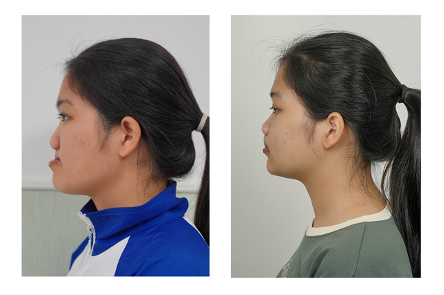 30 chuyên gia Mỹ quy tụ tại Bệnh viện Hồng Ngọc khám cho bệnh nhân nghèo dị tật- Ảnh 4. 30 chuyên gia Mỹ quy tụ tại Bệnh viện Hồng Ngọc khám cho bệnh nhân nghèo dị tật- Ảnh 4.