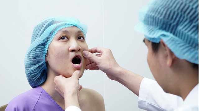 Hành trình 180 ngày lột xác của cô gái hàm ếch Minh Xuân- Ảnh 1.