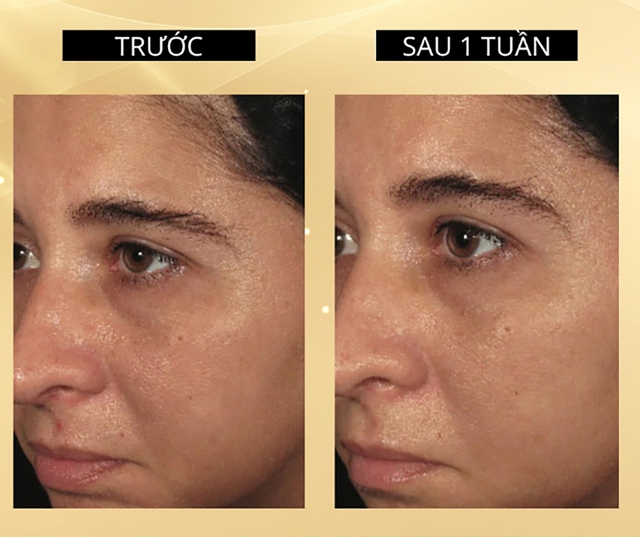 Review Image Ormedic c&oacute; tốt kh&ocirc;ng v&agrave; top 5 sản phẩm b&aacute;n chạy h&agrave;ng đầu hiện nay- Ảnh 3.