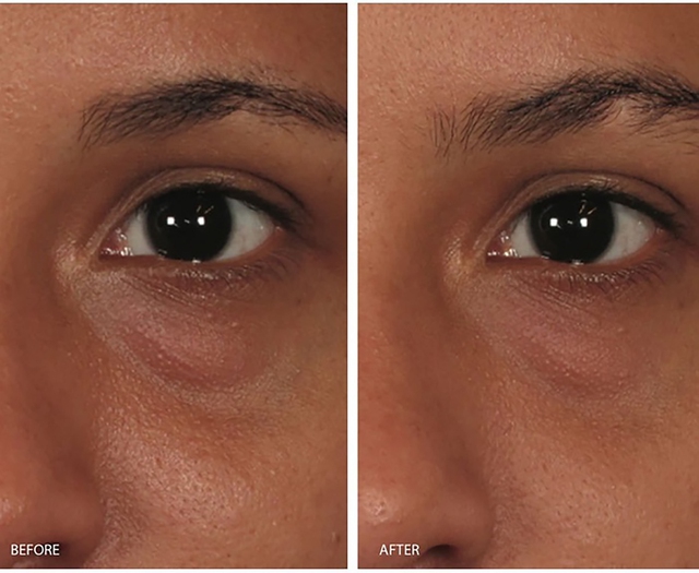 Review Image Ormedic c&oacute; tốt kh&ocirc;ng v&agrave; top 5 sản phẩm b&aacute;n chạy h&agrave;ng đầu hiện nay- Ảnh 9.