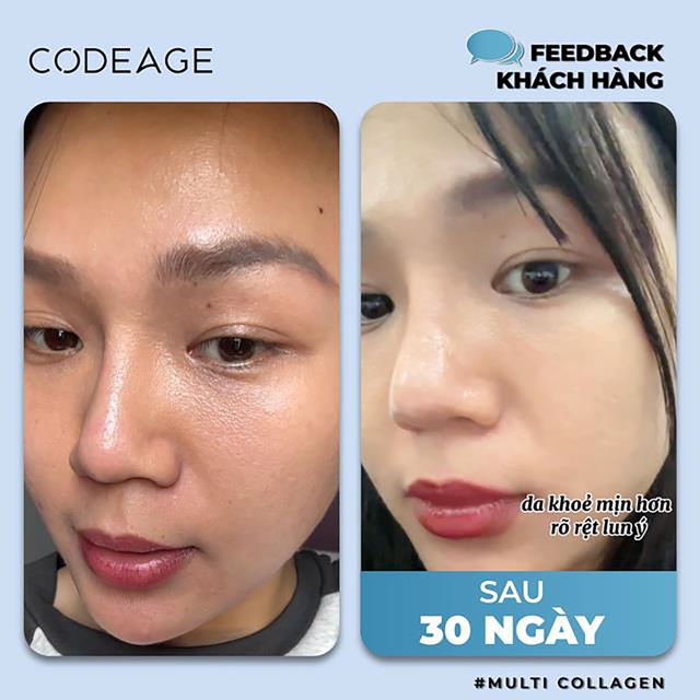 3 kiểu chị đẹp bị ‘hút cạn kiệt collagen’ lão hóa đến nhanh không kịp phanh- Ảnh 5.