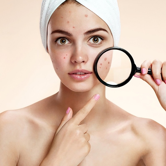 Chấm dứt nỗi lo da bị thâm mụn trong 4 tuần, da trắng sáng đều màu- Ảnh 3.