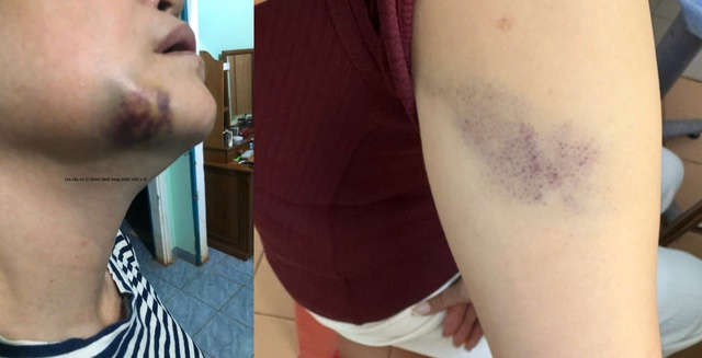 - Ảnh 2. - Ảnh 2.