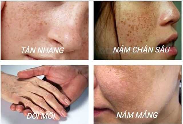 Review serum trị nám White Doctors có hiệu quả tận gốc nám chân sâu, nám mảng không?- Ảnh 6.