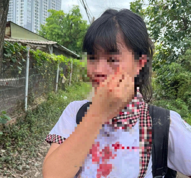 UBND TP.Thủ Đức báo cáo vụ nữ sinh bị hành hung dã man- Ảnh 1.