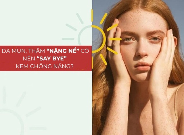 Da mụn, thâm 'nặng nề' có nên 'say bye' với kem chống nắng? - Ảnh 1. Da mụn, thâm 'nặng nề' có nên 'say bye' với kem chống nắng? - Ảnh 1.